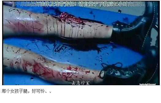 图解吧岛国片：邪恶护士2图解(19)(点击浏览下一张趣图)