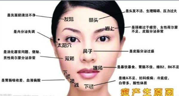 长痘痘的位置图解(点击浏览下一张趣图)