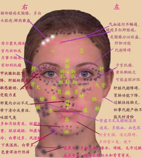 长痘痘的位置图解(3)(点击浏览下一张趣图)