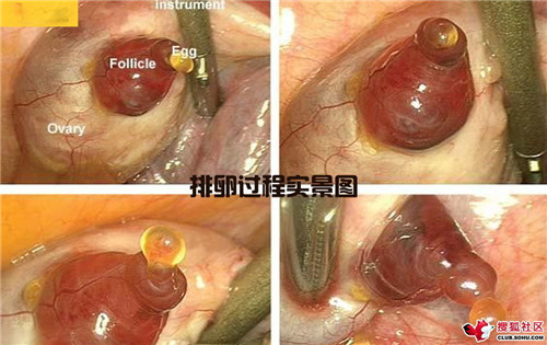 造人全过程图解：结婚晚上怎样造人(8)(点击浏览下一张趣图)