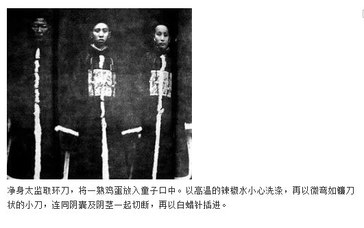 太监的净身过程图解(11)(点击浏览下一张趣图)