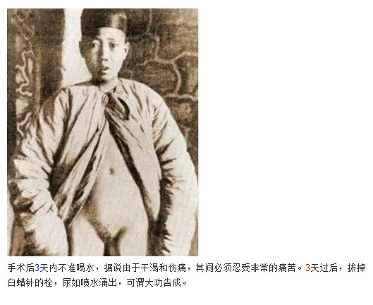 太监的净身过程图解(13)(点击浏览下一张趣图)