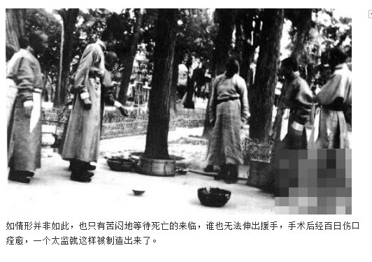 太监的净身过程图解(14)(点击浏览下一张趣图)