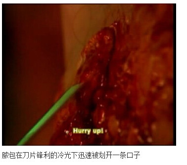 下水道的美人鱼图解(168)(点击浏览下一张趣图)