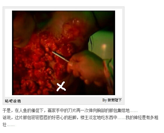 下水道的美人鱼图解(179)(点击浏览下一张趣图)