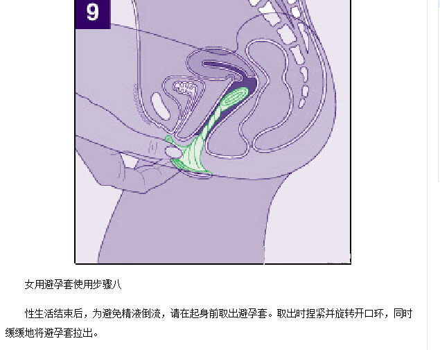 女用避孕套演示动态图(9)(点击浏览下一张趣图)