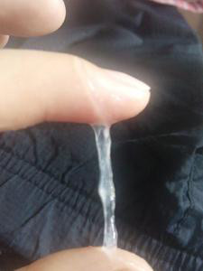 排卵期白带拉丝图片(点击浏览下一张趣图)