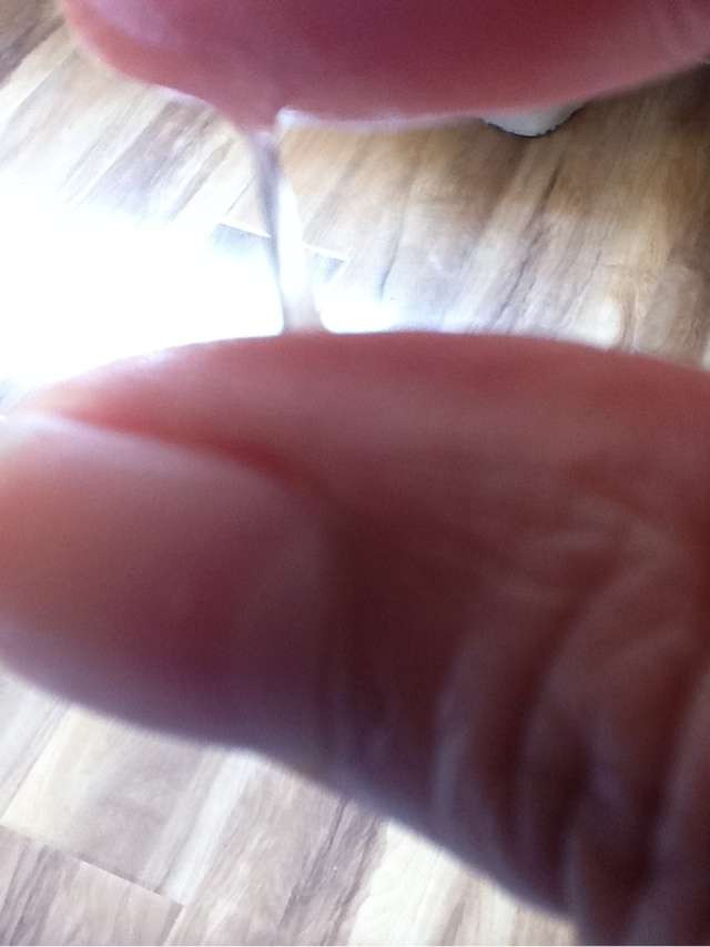 排卵期白带拉丝图片(5)(点击浏览下一张趣图)