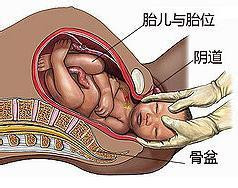自然分娩宫口开的图片 分娩无遮盖高清视频(4)(点击浏览下一张趣图)
