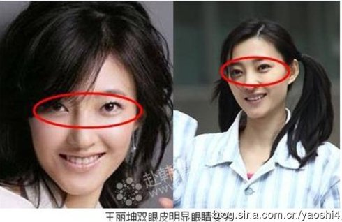 王丽坤整容前后照片(点击浏览下一张趣图)