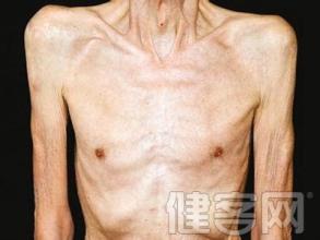 肺癌晚期死前症状(点击浏览下一张趣图)