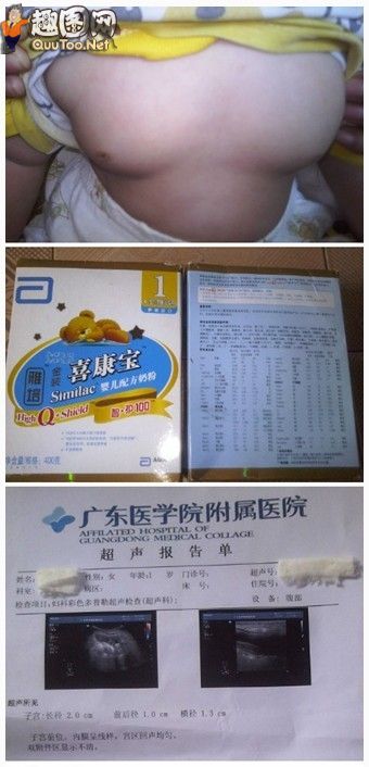  女童性早熟(点击浏览下一张趣图)