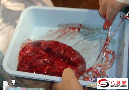 妇女自然分娩全过程图(2)(点击浏览下一张趣图)