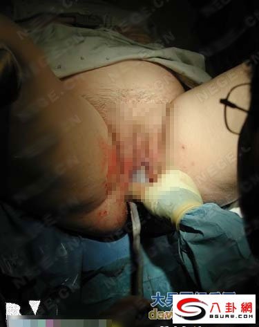 妇女自然分娩全过程图(4)(点击浏览下一张趣图)