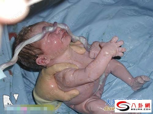 妇女自然分娩全过程图(6)(点击浏览下一张趣图)