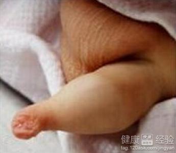 男性包茎手术多少钱(点击浏览下一张趣图)