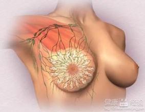 乳房溢乳怎么治(点击浏览下一张趣图)