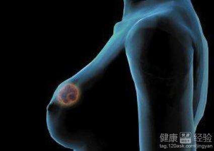 乳头溢液是什么原因(点击浏览下一张趣图)