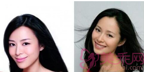 张静初整容前后对比图片(3)(点击浏览下一张趣图)