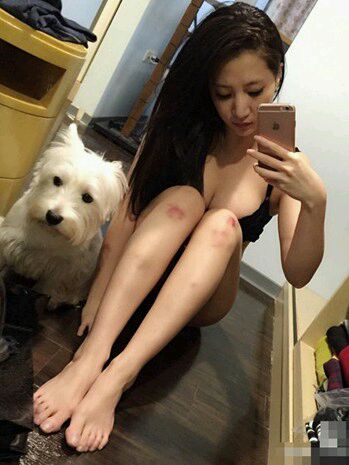 女生膝盖红是什么意思(点击浏览下一张趣图)