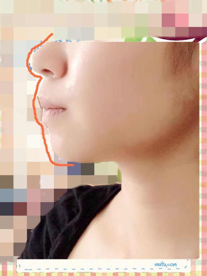 嘴巴突出来侧脸很难看(点击浏览下一张趣图)