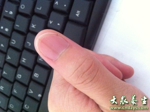大拇指指甲上有竖纹(点击浏览下一张趣图)