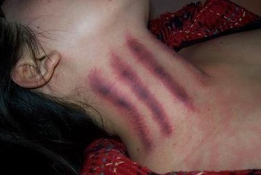 2977882910的揪痧图片 晚上给老婆揪痧视频(2)(点击浏览下一张趣图)