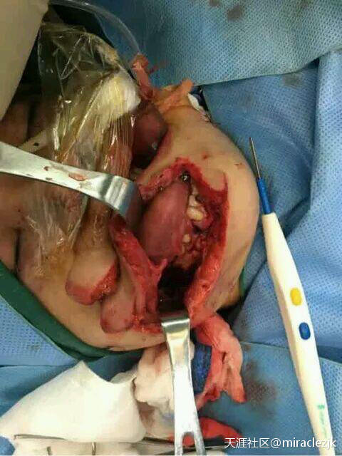 北京老虎吃人真实视频图片：北京老虎袭击游客视频(5)(点击浏览下一张趣图)