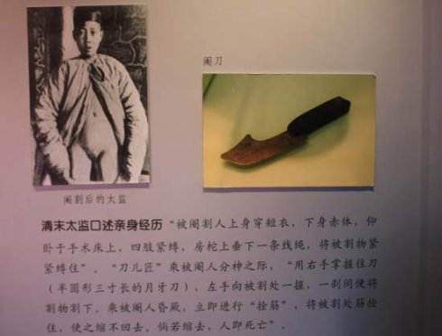 太监的净身过程图解(点击浏览下一张趣图)