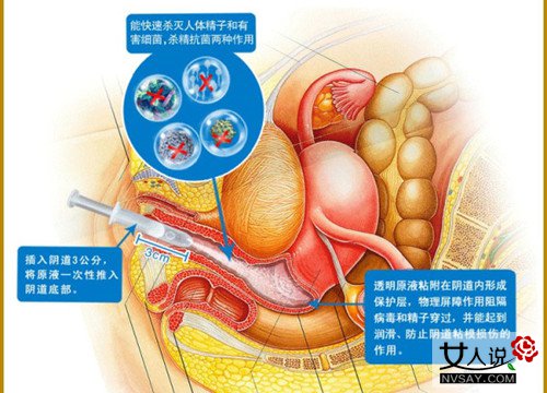 妇女液体避孕套图解 液体避孕套如何使用(2)(点击浏览下一张趣图)