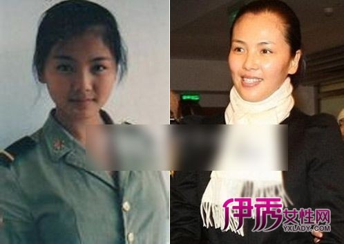 刘涛整容前后照片(2)(点击浏览下一张趣图)