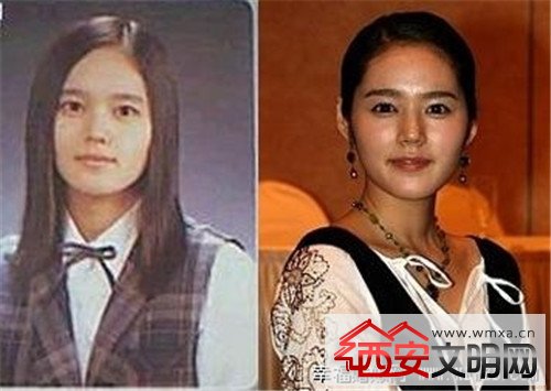 秋瓷炫整容前后对比照片(点击浏览下一张趣图)
