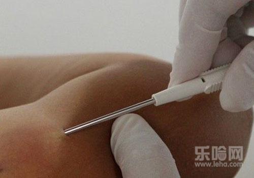 皮下埋植避孕法的危害(点击浏览下一张趣图)