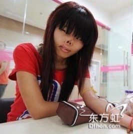 无鼻女有鼻子之后照片(2)(点击浏览下一张趣图)