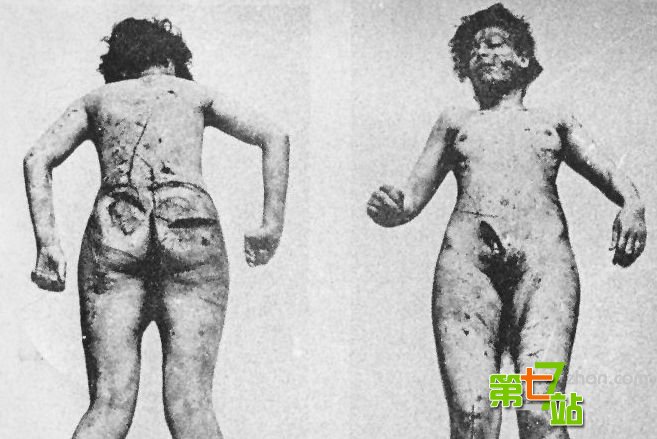 731部队女尸图：日军731部队性试验方法图解(6)(点击浏览下一张趣图)