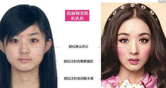 赵丽颖整容前后照片(点击浏览下一张趣图)