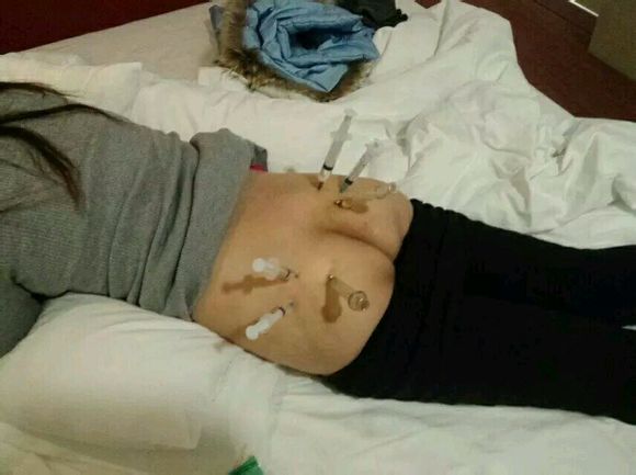女人光屁股大便图片：女人光屁股打针图(2)(点击浏览下一张趣图)