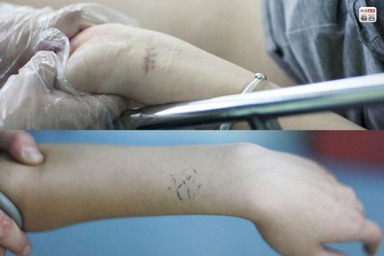 少女粉红嫩90后：未成年少女人流全过程(7)(点击浏览下一张趣图)