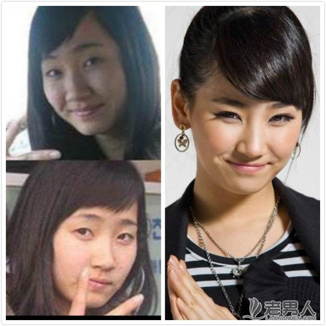 wonder girls整容前后对比照(点击浏览下一张趣图)