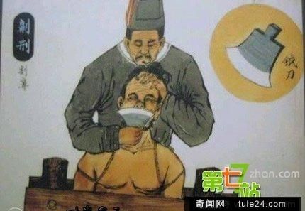 男性尿道可以扩张多大图 ：泥鳅钻进男子尿道(3)(点击浏览下一张趣图)