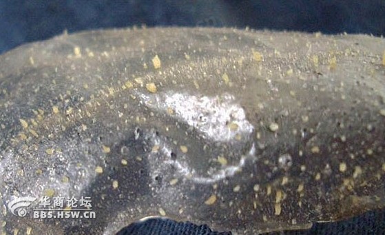 黑头拔出来的样子图片(3)(点击浏览下一张趣图)