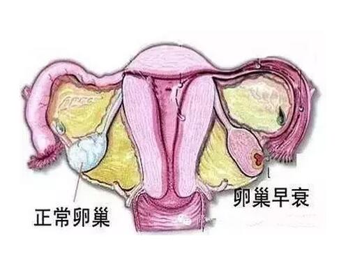 卵巢早衰的症状有哪些，卵巢早衰的症状吃什么(点击浏览下一张趣图)