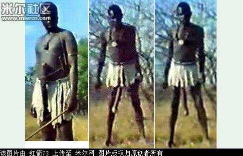 世界上丁丁最小的人：最小丁丁有多小图片 世界上最小的丁丁多大(点击浏览下一张趣图)