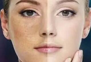 女人皮肤粗糙暗黄吃什么好/(点击浏览下一张趣图)