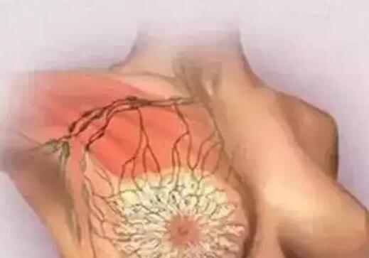 乳腺知识普及，乳腺女人的生命线(点击浏览下一张趣图)