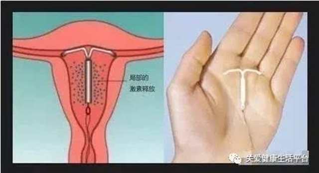 月经走后几天下面变紧(2)(点击浏览下一张趣图)