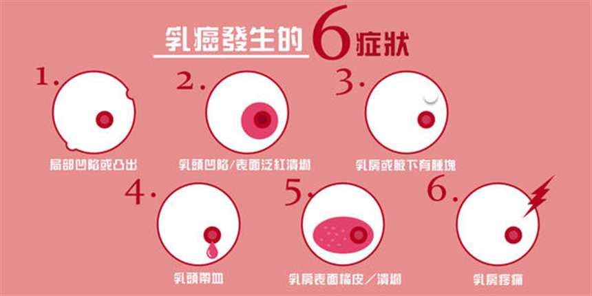 “防癌于未然”乳腺癌的15个征兆(点击浏览下一张趣图)