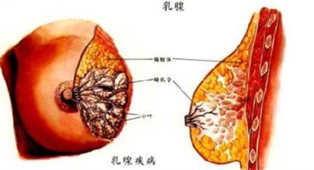 乳腺癌的十大早期信号 一定要重视起来！(点击浏览下一张趣图)
