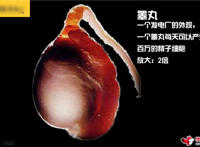 造人全过程图解：结婚晚上怎样造人