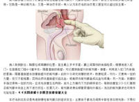 前列腺保健按摩图解：按摩前列腺手法图解